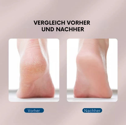 Serenosole™ SmoothSole | Verwandle deine Füße mit müheloser Glätte | Beste Fußpflege 2025