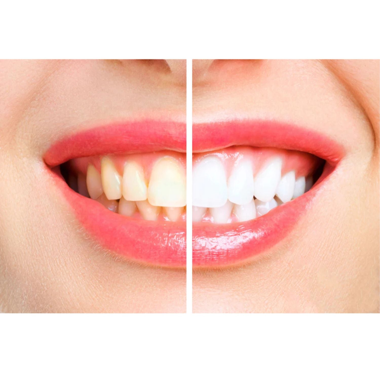 Serenosole™ VibrantSmile | Reinigt deine Zähne wie ein Profi mit kraftvollen Vibrationen | Perfekte Zahnbürste 2025